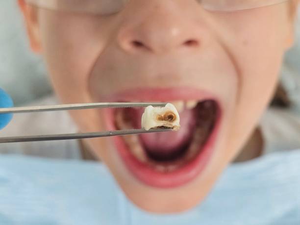 Best Tooth Infection Emergency Dentist  in Sto Brook University, NY